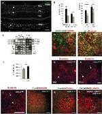 ZO-1 Antibody in Immunohistochemistry (IHC)