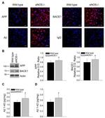 beta Amyloid Antibody in Immunohistochemistry (IHC)