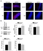 beta Amyloid Antibody in Immunohistochemistry (IHC)