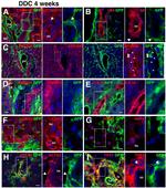 CD133 (Prominin-1) Antibody in Immunohistochemistry (IHC)