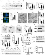 LAMP-2A Antibody in Immunocytochemistry (ICC/IF)