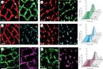 Calsequestrin Antibody in Immunohistochemistry (IHC)