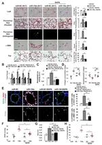 PCNA Antibody in Immunohistochemistry (IHC)