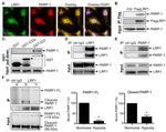 PARP1 Antibody in Immunocytochemistry (ICC/IF)