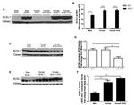 Calsequestrin Antibody in Western Blot (WB)