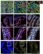 CD326 (EpCAM) Antibody in Immunohistochemistry (IHC)