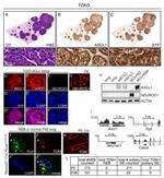 Synaptophysin Antibody in Immunohistochemistry (Paraffin) (IHC (P))