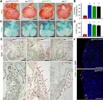 CD68 Antibody in Immunohistochemistry (IHC)