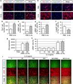 CD90 (Thy-1) Antibody in Immunohistochemistry (IHC)