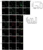 Phospho-Tau (Ser262) Antibody in Immunocytochemistry (ICC/IF)