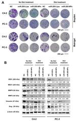 ZEB1 Antibody in Western Blot (WB)