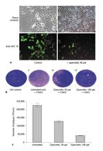 HSC70 Antibody in Immunocytochemistry, Immunohistochemistry (ICC/IF, IHC)