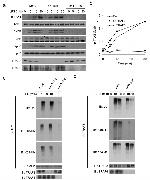 Ubiquitin Antibody in Immunoprecipitation (IP)