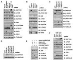 BTRC Antibody in Western Blot (WB)