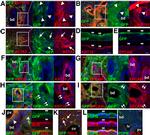 Podoplanin Antibody in Immunocytochemistry, Immunohistochemistry (ICC/IF, IHC)