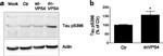 Phospho-Tau (Ser396) Antibody in Western Blot (WB)