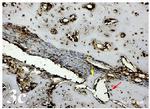 Osteopontin Antibody in Immunohistochemistry (IHC)