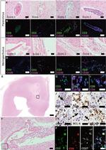 Ki-67 Antibody in Immunohistochemistry (IHC)