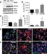 BMPR2 Antibody in Immunohistochemistry (IHC)