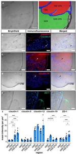 Claudin 5 Antibody in Immunohistochemistry (IHC)