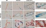 beta Galactosidase Antibody in Immunohistochemistry (IHC)