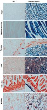 beta Galactosidase Antibody in Immunohistochemistry (IHC)