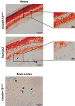 beta Galactosidase Antibody in Immunohistochemistry (IHC)