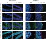 CD140b (PDGFRB) Antibody in Immunocytochemistry, Immunohistochemistry (ICC/IF, IHC)