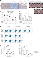 FOXP3 Antibody in Immunohistochemistry (IHC)