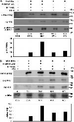 Phospho-IkB alpha (Ser32, Ser36) Antibody in Western Blot (WB)