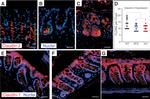 Claudin 1 Antibody in Immunohistochemistry (IHC)