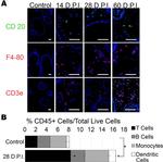 CD20 Antibody in Immunocytochemistry, Immunohistochemistry (ICC/IF, IHC)