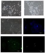 Cytokeratin 18 Antibody in Immunocytochemistry (ICC/IF)