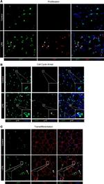 Podoplanin Antibody in Immunocytochemistry (ICC/IF)