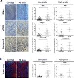 Granzyme B Antibody in Immunohistochemistry (IHC)