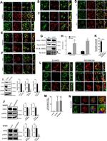 Ezrin Antibody in Proximity Ligation Assay (PLA) (PLA)