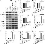 Alpha-Smooth Muscle Actin Antibody in Western Blot (WB)