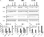 PYGL Antibody in Western Blot (WB)