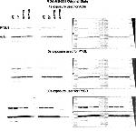 PYGL Antibody in Western Blot (WB)