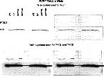 PYGL Antibody in Western Blot (WB)