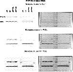 PYGL Antibody in Western Blot (WB)