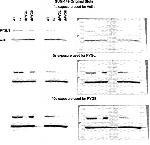 PYGL Antibody in Western Blot (WB)