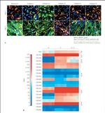 Collagen IV Antibody in Immunocytochemistry (ICC/IF)