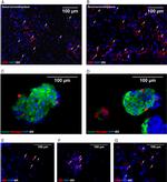 CD68 Antibody in Immunohistochemistry (IHC)