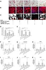 IFN gamma Antibody in Neutralization (Neu)