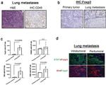 FOXP3 Antibody in Immunocytochemistry, Immunohistochemistry (ICC/IF, IHC)