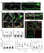 MASH1 Antibody in Immunohistochemistry (IHC)