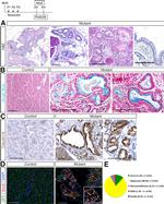 Claudin 18 Antibody in Immunohistochemistry (IHC)