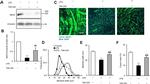 Myosin 4 Antibody in Western Blot, Immunocytochemistry (WB, ICC/IF)