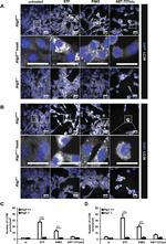 LC3B Antibody in Immunocytochemistry (ICC/IF)